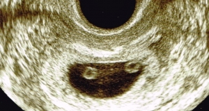 7w