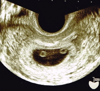 7w